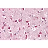 Immunohistochemistry - Anti-GluK1 Antibody (A83293) - Antibodies.com