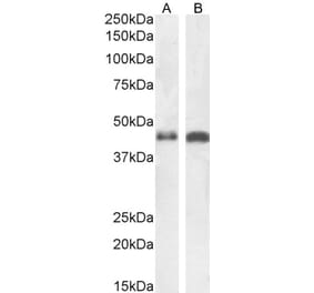 Western Blot - Anti-beta Arrestin 2 Antibody (A83294) - Antibodies.com