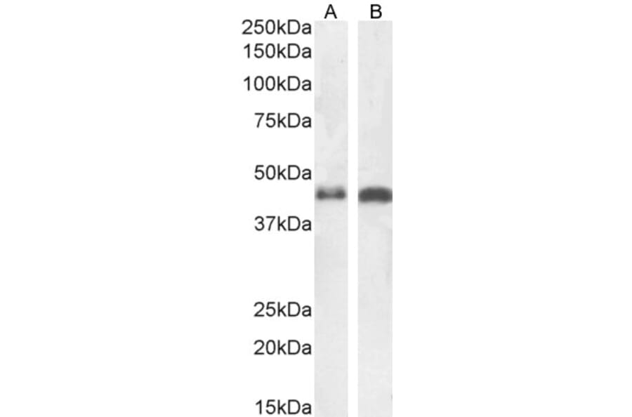 Western Blot - Anti-beta Arrestin 2 Antibody (A83294) - Antibodies.com