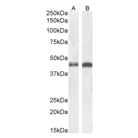 Western Blot - Anti-beta Arrestin 2 Antibody (A83294) - Antibodies.com