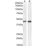 Western Blot - Anti-beta Arrestin 2 Antibody (A83294) - Antibodies.com