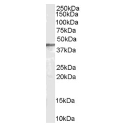 Western Blot - Anti-ARRB2 Antibody (A83294) - Antibodies.com