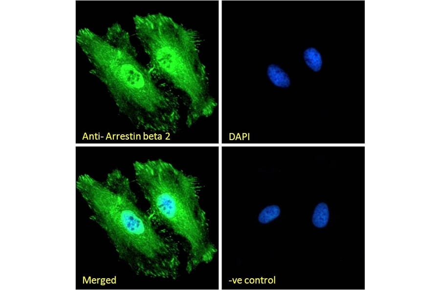 Immunofluorescence - Anti-beta Arrestin 2 Antibody (A83294) - Antibodies.com