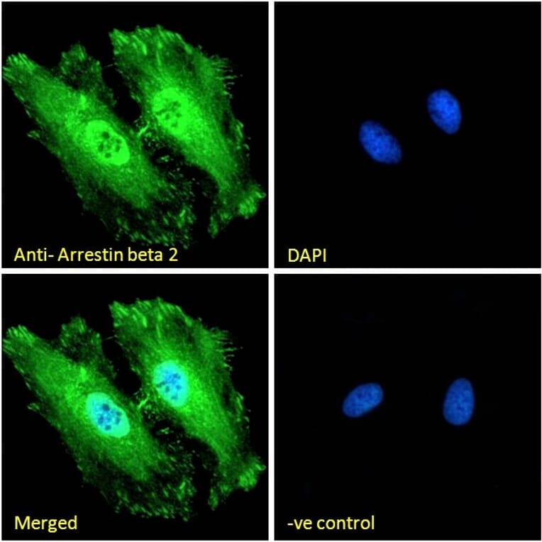 Immunofluorescence - Anti-beta Arrestin 2 Antibody (A83294) - Antibodies.com