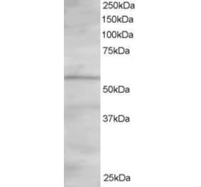 Western Blot - Anti-ORP2 Antibody (A83296) - Antibodies.com