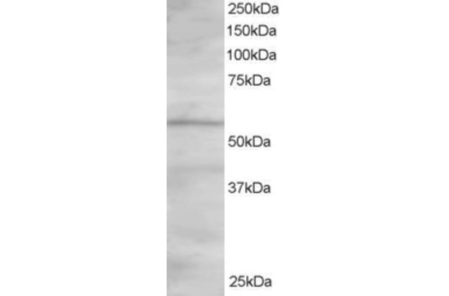 Western Blot - Anti-ORP2 Antibody (A83296) - Antibodies.com