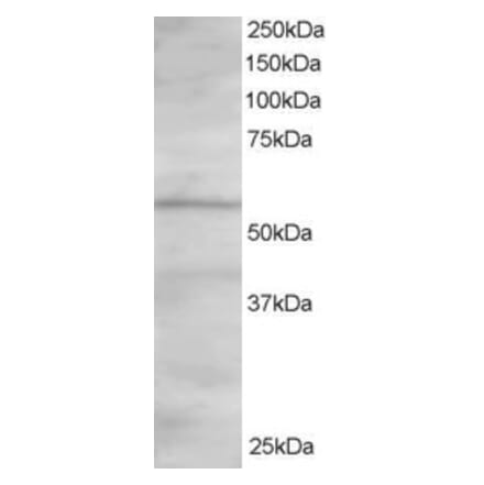 Western Blot - Anti-ORP2 Antibody (A83296) - Antibodies.com