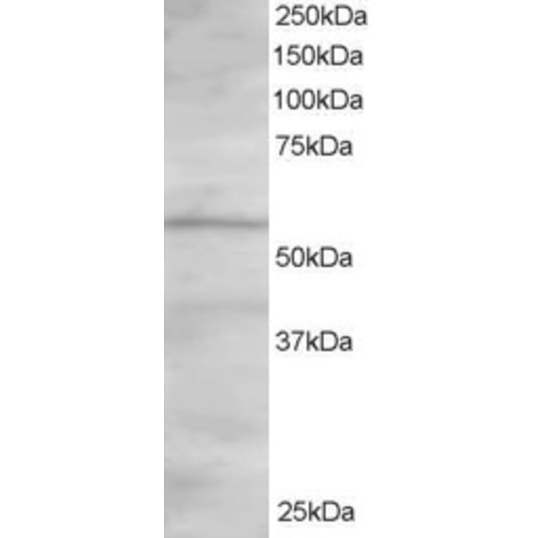 Western Blot - Anti-ORP2 Antibody (A83296) - Antibodies.com