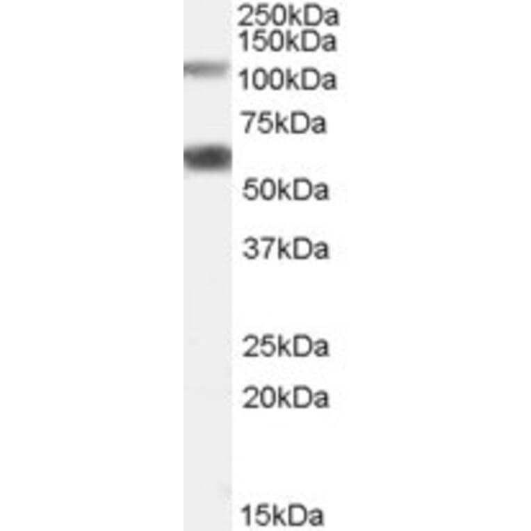 Western Blot - Anti-OGT/O-Linked N-Acetylglucosamine Transferase Antibody (A83298) - Antibodies.com
