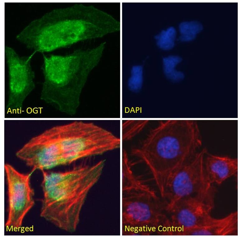 Immunofluorescence - Anti-OGT/O-Linked N-Acetylglucosamine Transferase Antibody (A83298) - Antibodies.com