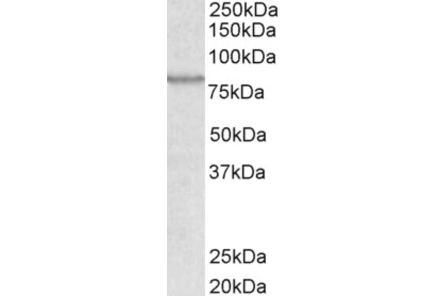 Western Blot - Anti-ABCB5 Antibody (A83299) - Antibodies.com