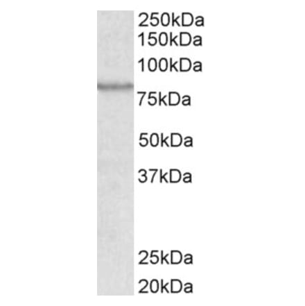 Western Blot - Anti-ABCB5 Antibody (A83299) - Antibodies.com