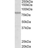 Western Blot - Anti-ABCB5 Antibody (A83299) - Antibodies.com
