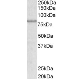 Western Blot - Anti-ABCB5 Antibody (A83299) - Antibodies.com