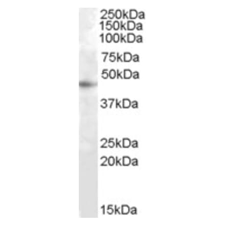 Western Blot - Anti-RASSF6 Antibody (A83300) - Antibodies.com