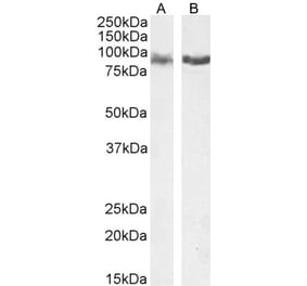 Western Blot - Anti-IFT88 Antibody (A83301) - Antibodies.com