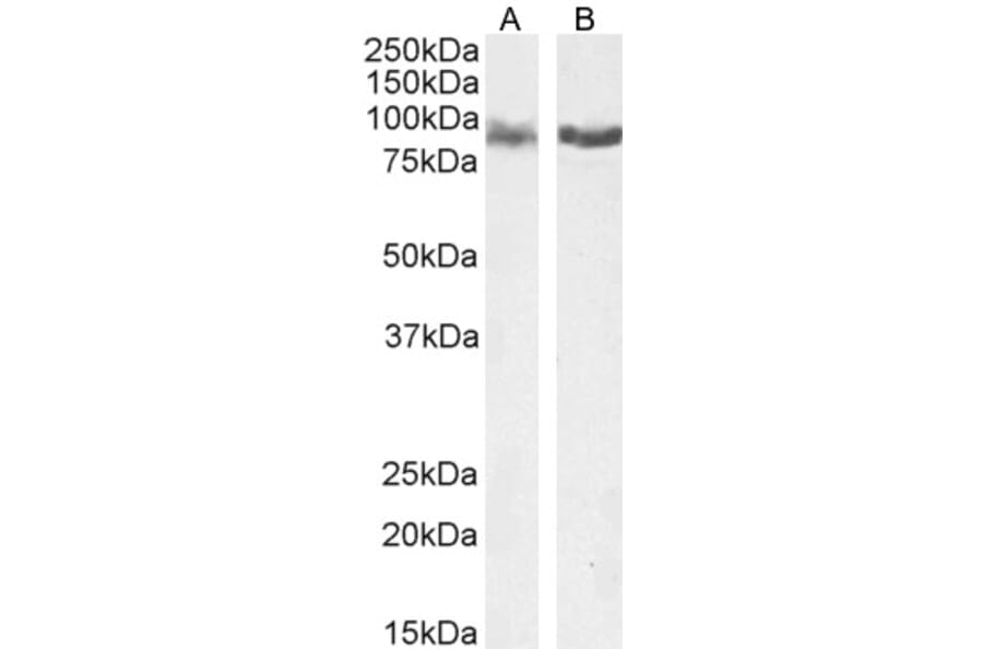 Western Blot - Anti-IFT88 Antibody (A83301) - Antibodies.com