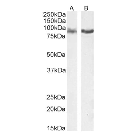 Western Blot - Anti-IFT88 Antibody (A83301) - Antibodies.com