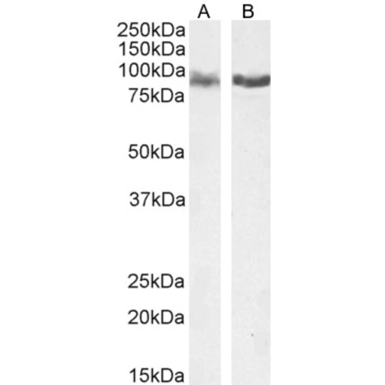 Western Blot - Anti-IFT88 Antibody (A83301) - Antibodies.com