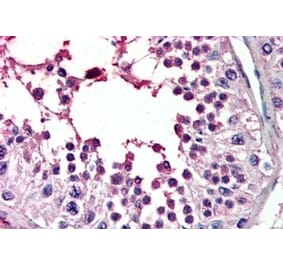 Immunohistochemistry - Anti-PIAS2 Antibody (A83302) - Antibodies.com