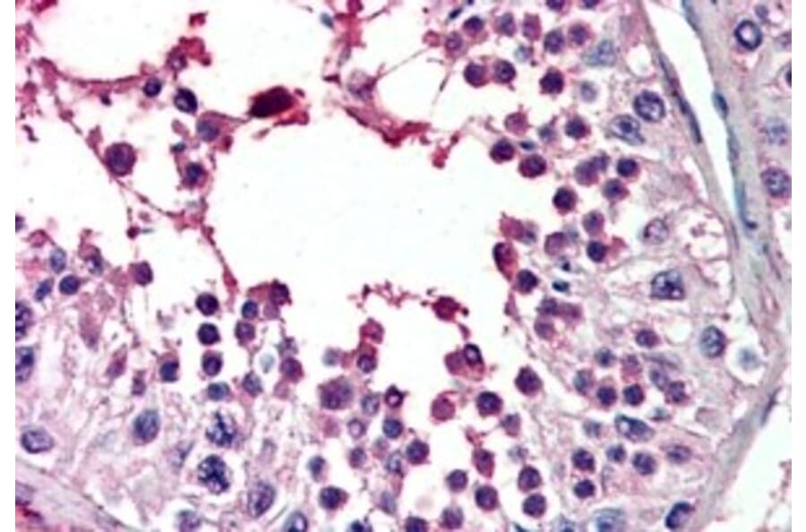 Immunohistochemistry - Anti-PIAS2 Antibody (A83302) - Antibodies.com