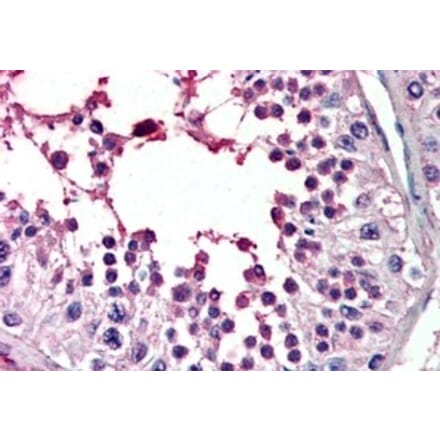 Immunohistochemistry - Anti-PIAS2 Antibody (A83302) - Antibodies.com