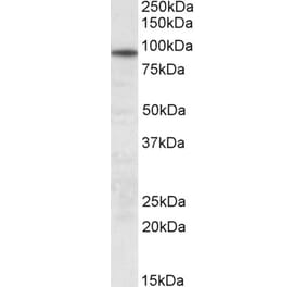 Western Blot - Anti-UNC45B Antibody (A83303) - Antibodies.com