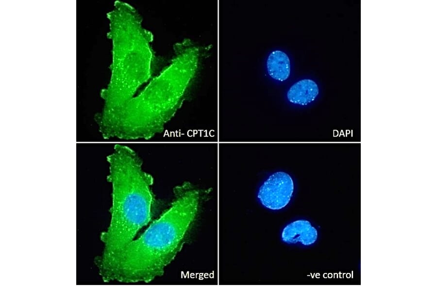 Immunofluorescence - Anti-Cpt1c/CPT1-B Antibody (A83304) - Antibodies.com