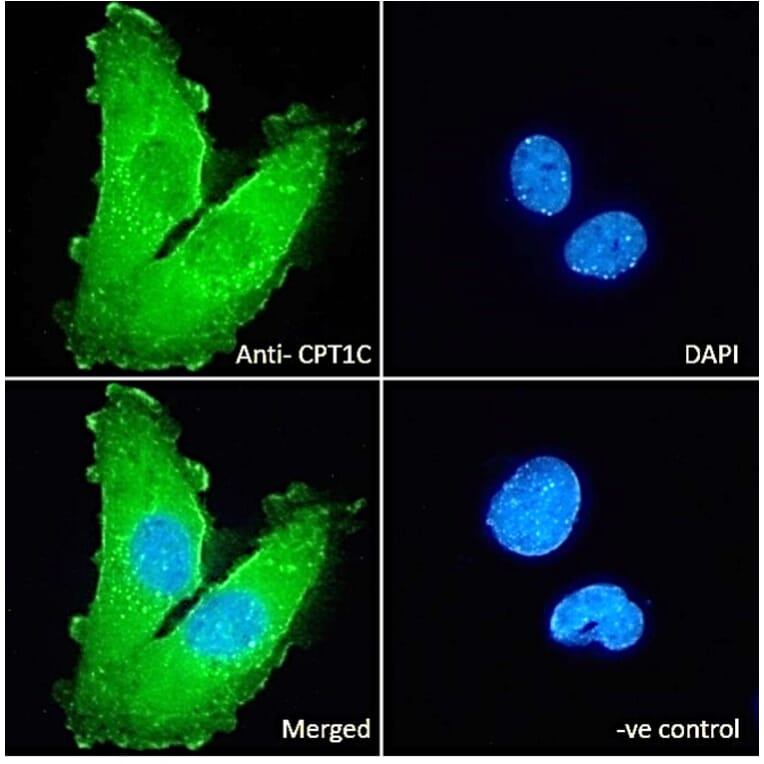 Immunofluorescence - Anti-Cpt1c/CPT1-B Antibody (A83304) - Antibodies.com