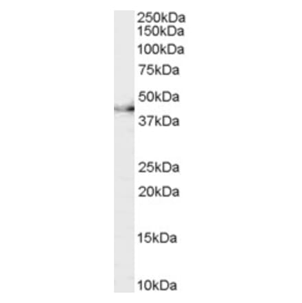 Western Blot - Anti-CNTFR Antibody (A83305) - Antibodies.com