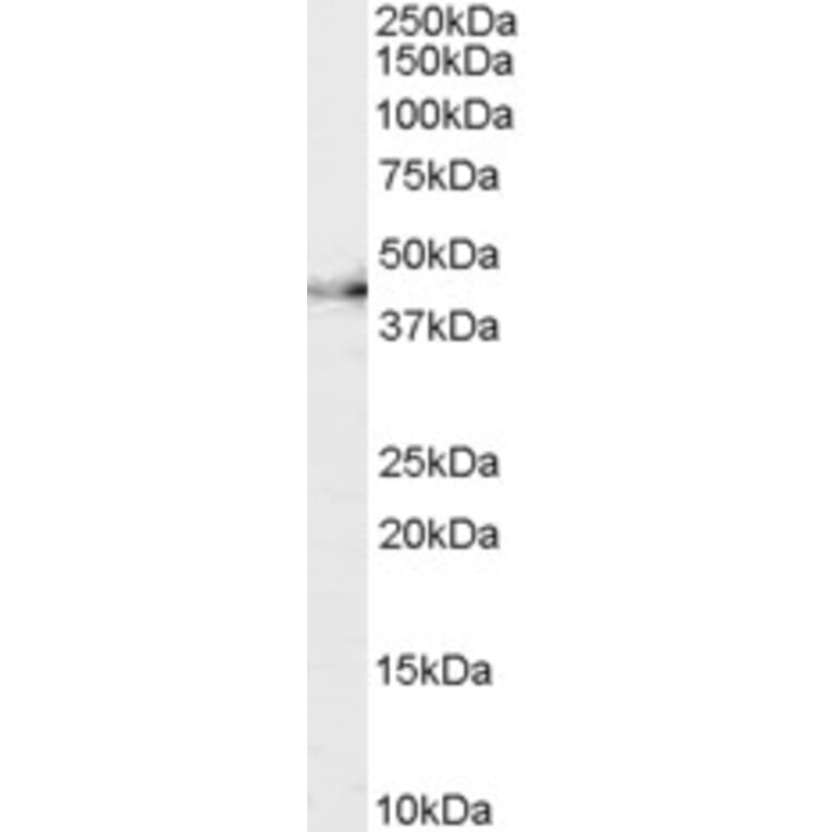 Western Blot - Anti-CNTFR Antibody (A83305) - Antibodies.com