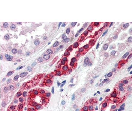 Immunohistochemistry - Anti-GGA3 Antibody (A83306) - Antibodies.com