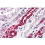 Immunohistochemistry - Anti-GGA3 Antibody (A83306) - Antibodies.com