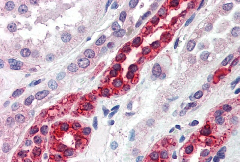 Anti-GGA3 Antibody (A83306) (5µg/ml) staining of paraffin embedded Human Kidney. Steamed antigen retrieval with citrate buffer pH 6, AP-staining.