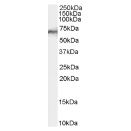 Western Blot - Anti-SHP1 Antibody (A83308) - Antibodies.com