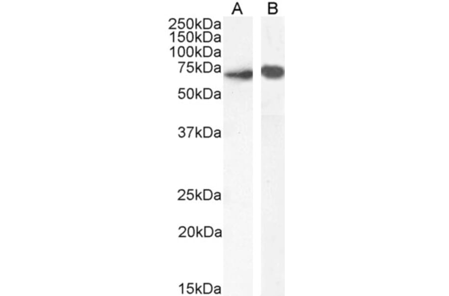 Western Blot - Anti-SHP1 Antibody (A83308) - Antibodies.com
