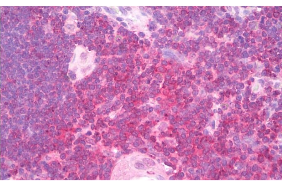 Immunohistochemistry - Anti-SHP1 Antibody (A83308) - Antibodies.com