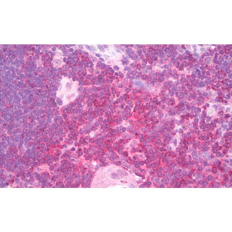 Immunohistochemistry - Anti-SHP1 Antibody (A83308) - Antibodies.com
