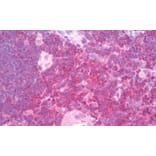 Immunohistochemistry - Anti-SHP1 Antibody (A83308) - Antibodies.com