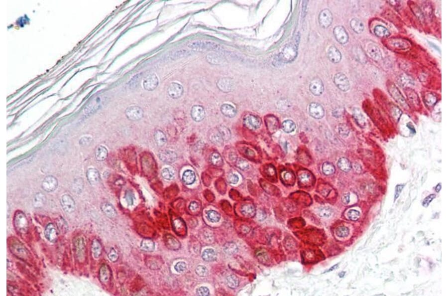 Immunohistochemistry - Anti-ATG16L1 Antibody (A83310) - Antibodies.com