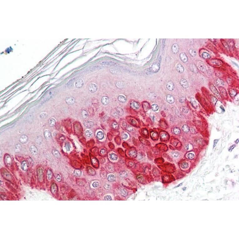 Immunohistochemistry - Anti-ATG16L1 Antibody (A83310) - Antibodies.com