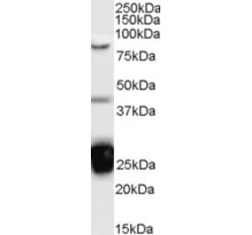 Western Blot - Anti-TIA1 Antibody (A83311) - Antibodies.com