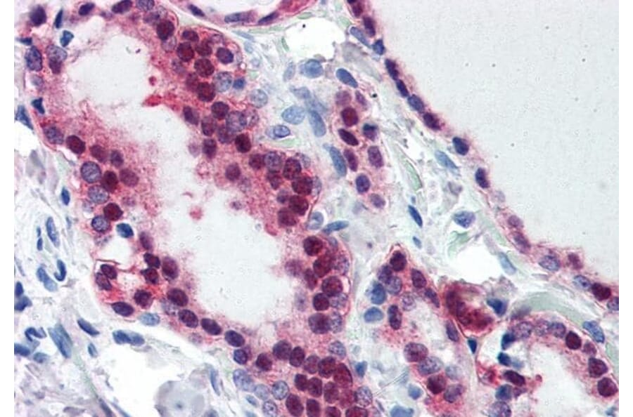 Immunohistochemistry - Anti-TIA1 Antibody (A83311) - Antibodies.com