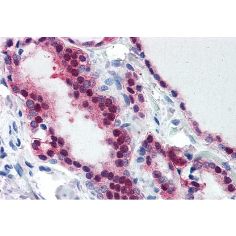 Immunohistochemistry - Anti-TIA1 Antibody (A83311) - Antibodies.com