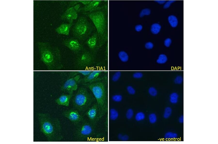 Immunofluorescence - Anti-TIA1 Antibody (A83311) - Antibodies.com