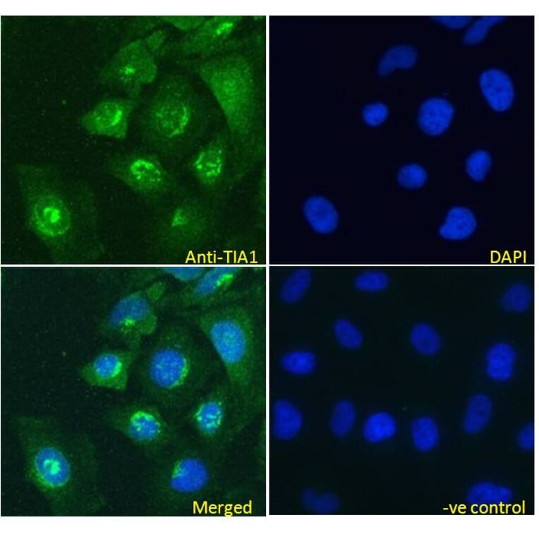 Immunofluorescence - Anti-TIA1 Antibody (A83311) - Antibodies.com