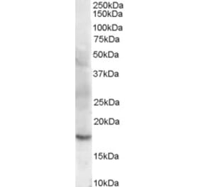 Western Blot - Anti-Cofilin 2 Antibody (A83312) - Antibodies.com