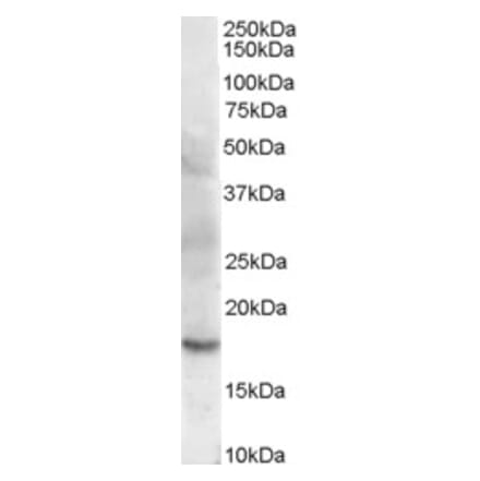 Western Blot - Anti-Cofilin 2 Antibody (A83312) - Antibodies.com