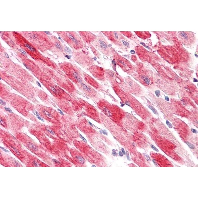Immunohistochemistry - Anti-Cofilin 2 Antibody (A83312) - Antibodies.com