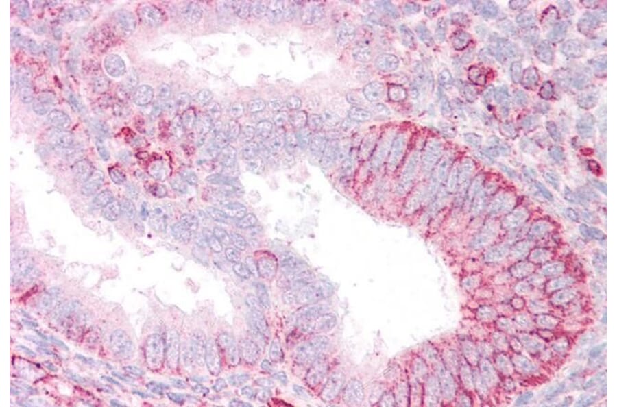 Immunohistochemistry - Anti-RNF23 Antibody (A83313) - Antibodies.com